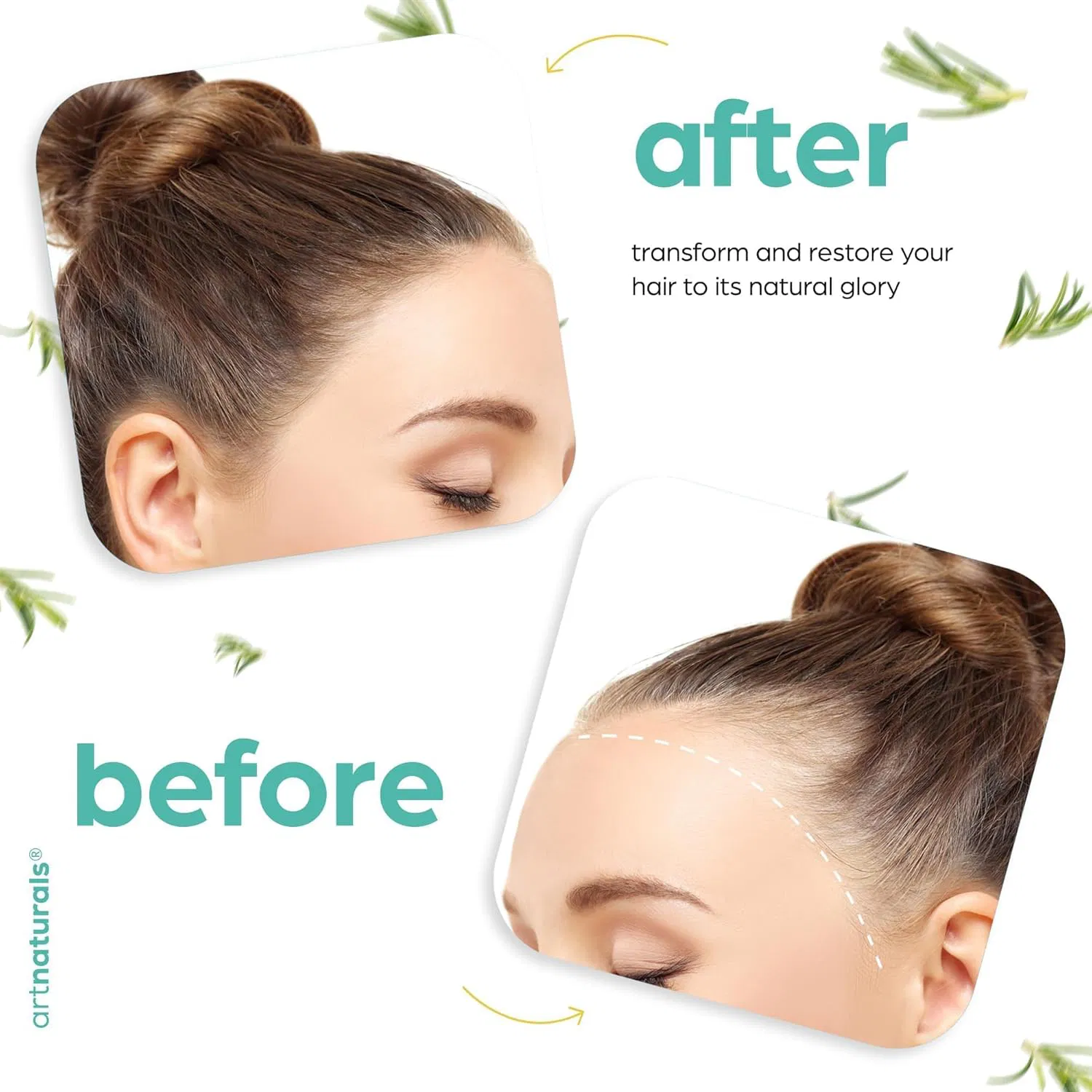 Organic Rosemary & Castor Hair Growth Oil for Dry Itchy Scalp Thickening & Hydration