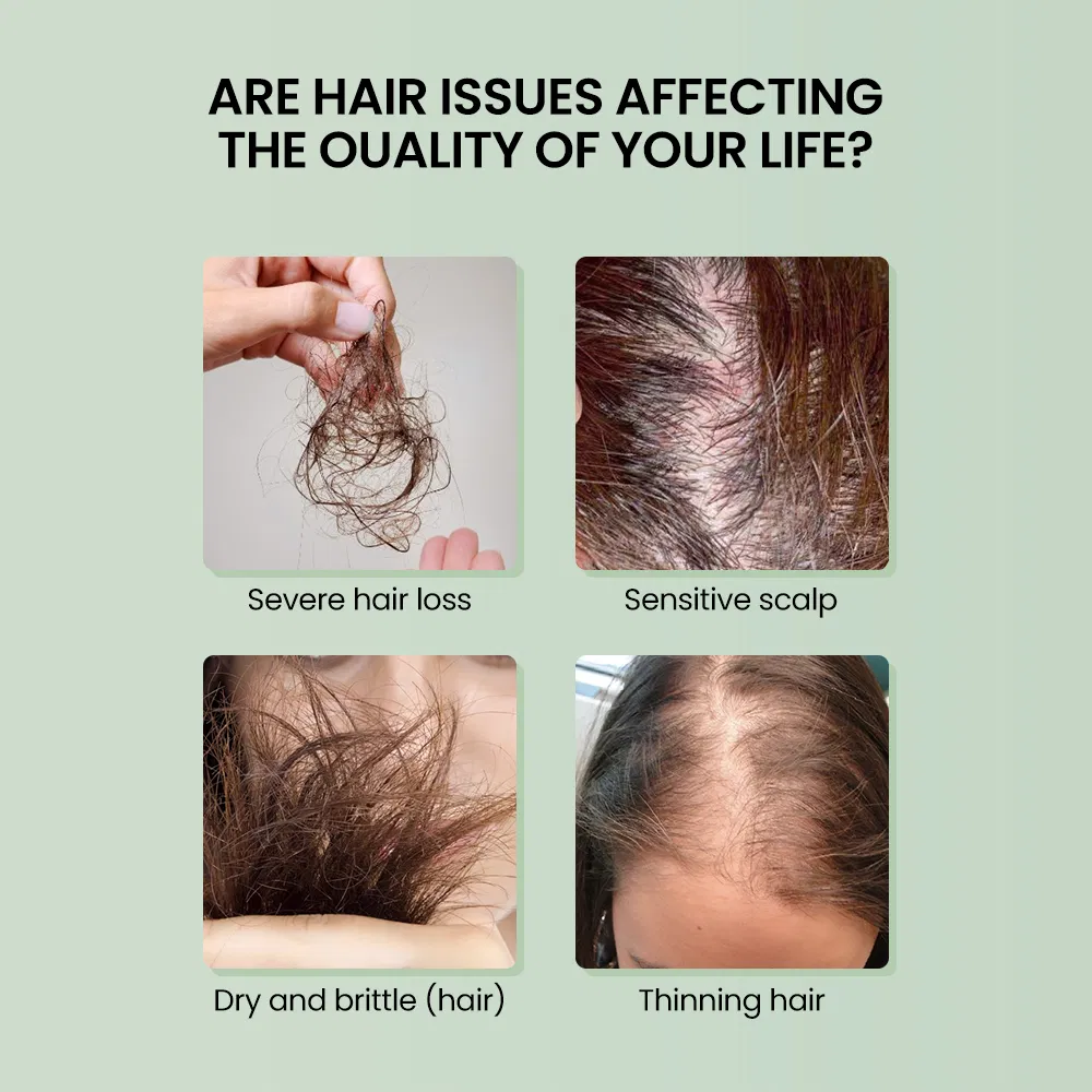 Private Label Hair Growth Hair Oil Best Natural Hair Growth Oil with Rosemary Castor