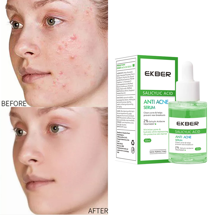 Hot Selling Ekber 30ml Azelaic Acid 15% Facial Serum with Centella Black Head Remover Face Care Azelaic Acid Serum