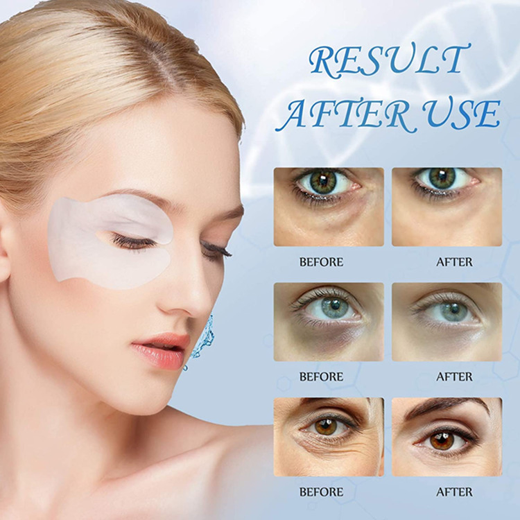 OEM/ODM Hyaluronic Acid Eye Mask Moisturizing Circle Eye Mask Patches