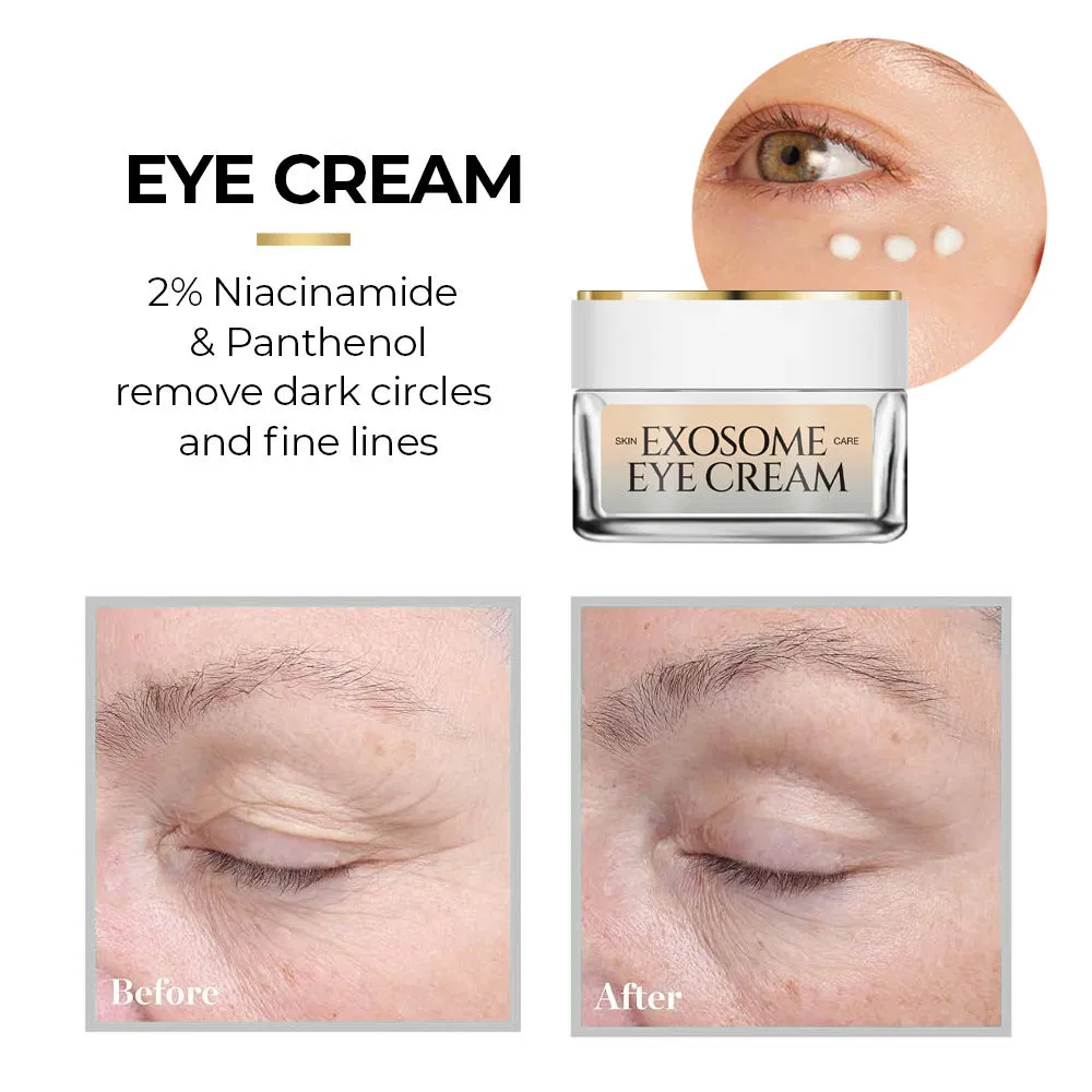 Herbal Moisturizer Exosome Eye Cream Anti-Aging Anti-Wrinkle Eye Bags Dark Circles Removal