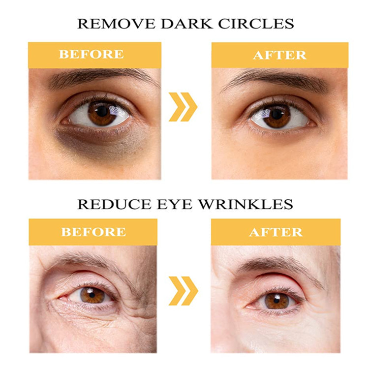 OEM/ODM 24K Gold Under Eye Mask for Fine Lines and Wrinkles Treatment
