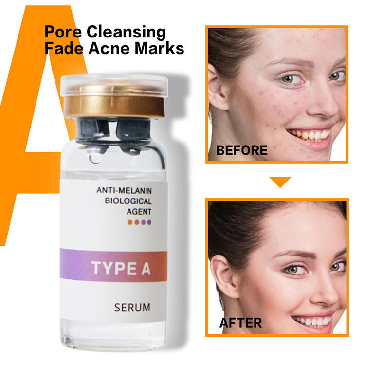 Body Skin Face Skin Ampoule Serum 10ml Cosmetics Whitening Melasma Serum 10ml
