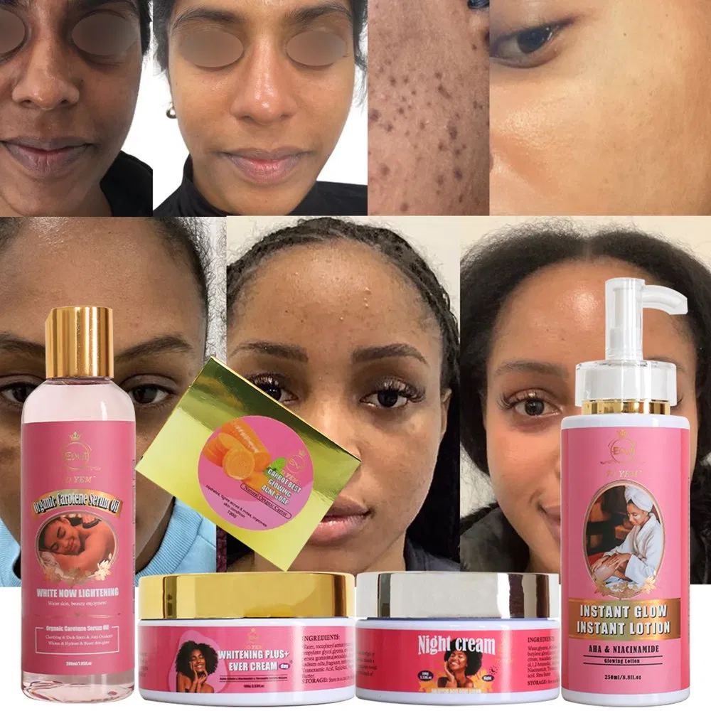 Best Skin Whitening Natural Carrot Vitamin a Vitamin C Glutathione Best Skin Lightening Whitening Kits