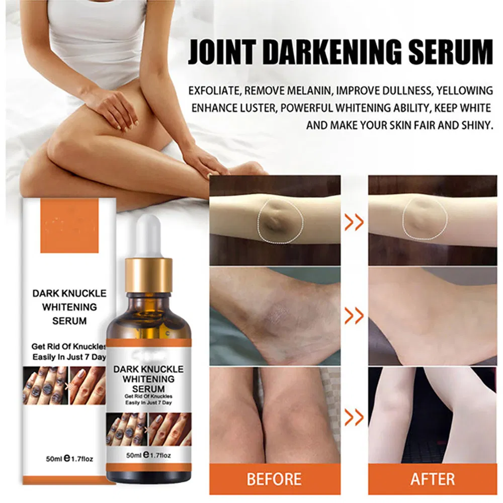 Own Brand Whitening and Exfoliating Joint Essence Nicotinamide to Dull and Brighten Skin Joint Essential Oil