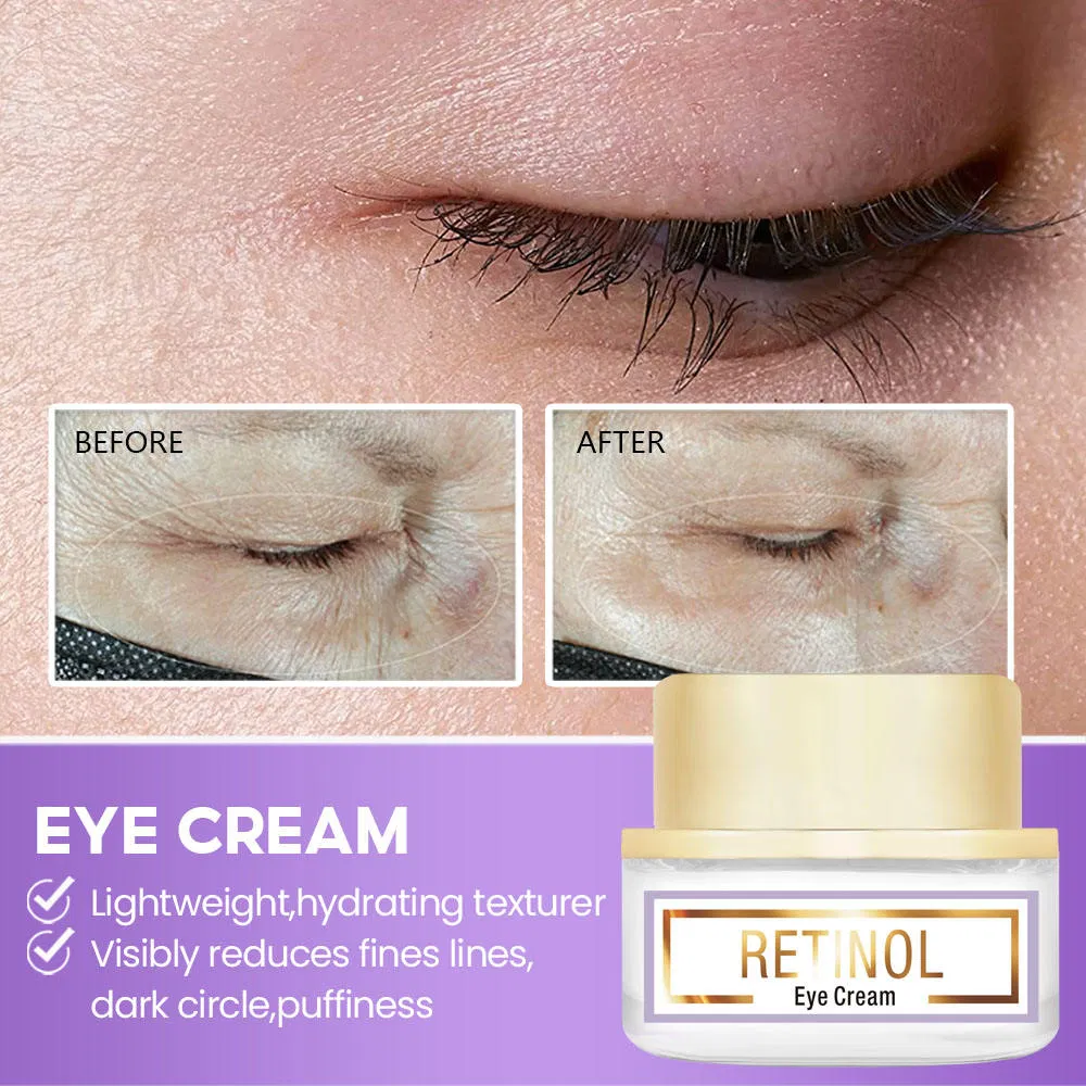 Women Retinol Anti Aging Eye Bags Removal Wrinkle Eye Cream