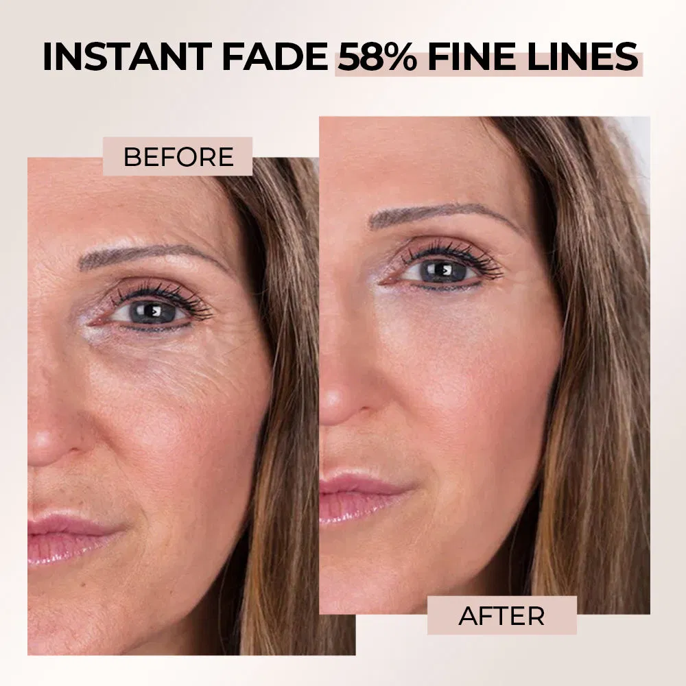 PRO Xyline Anti-Aging Removes Wrinkles Dark Circles Eye Bags Eye Cream