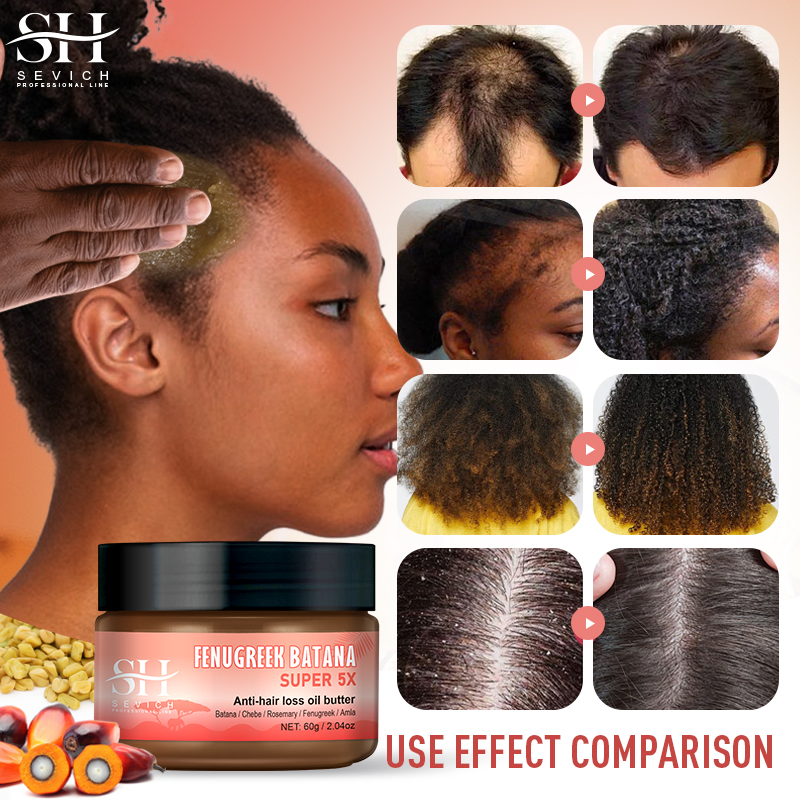 Private Label Natural Batana Hair Thickening Treatment Anti Hair Loss Batana Super 5X Hair Growth Butter