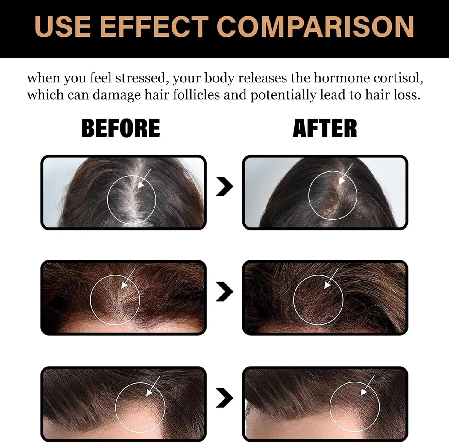 Anti-Hair Loss Shampoo Stimulate Growth Strengthen Roots Fuller Looking Hair
