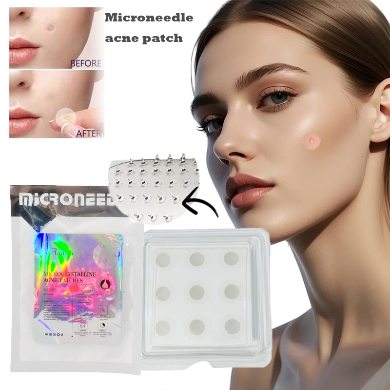 OEM White Microneedles Anti Aging Eye Patch Round Acne Pimple Patch Dissolved Micro Needle Acne Dark Spot Removal Patch