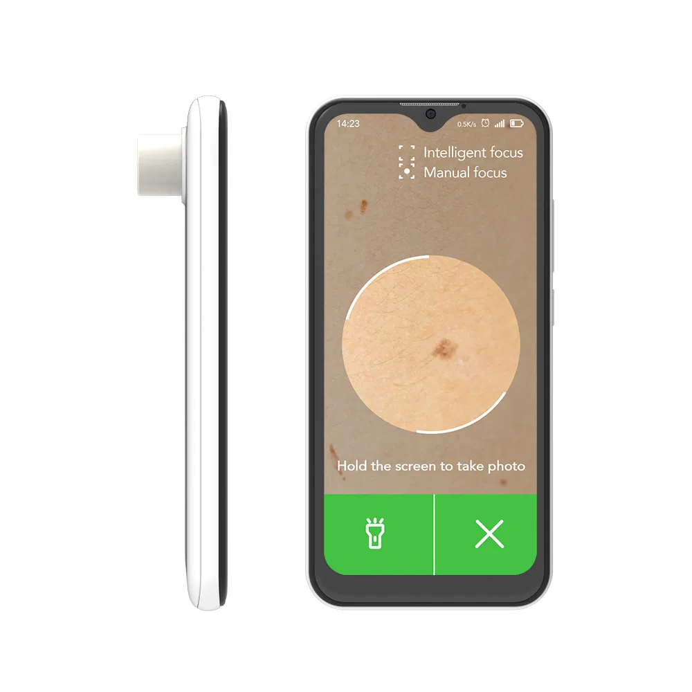 Custom 5 Inch Android Smartphone 4G Smartphone 720*1280 HD Mipi Mt6739 with 4X/60X Magnify Lens Skin Care Tools