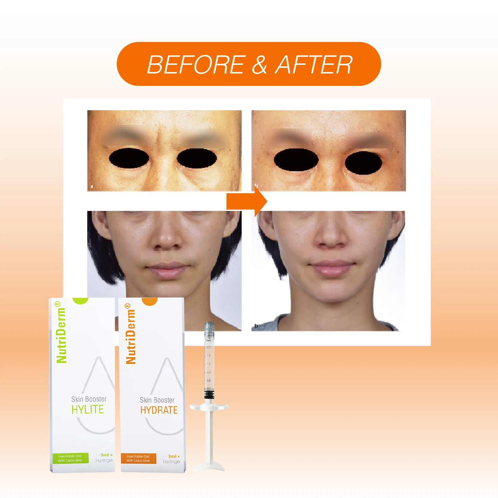 Neck Wrinkle Removal Lightening Tightening Serum Skin Booster Injectable Skin Rejuvenation