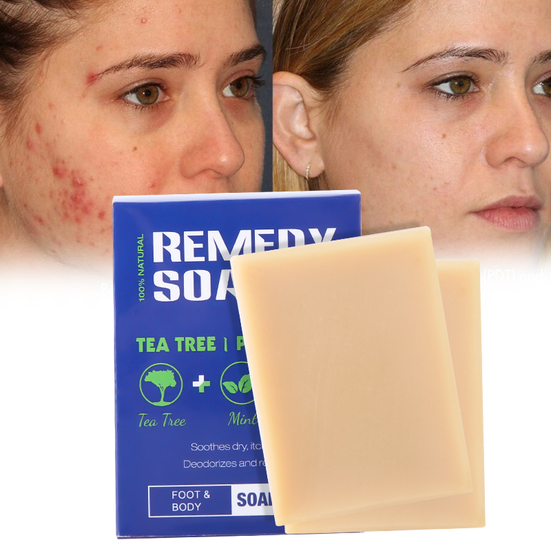 Refreshing Deep Cleansing Nourishing Remedy Remove Mites Anit-Acne Tea Tree Soap