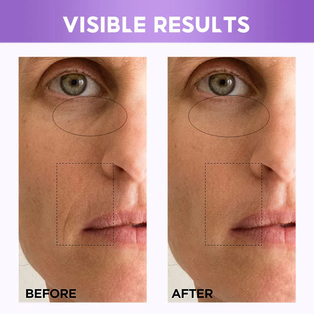 Women Retinol Anti Aging Eye Bags Removal Wrinkle Eye Cream