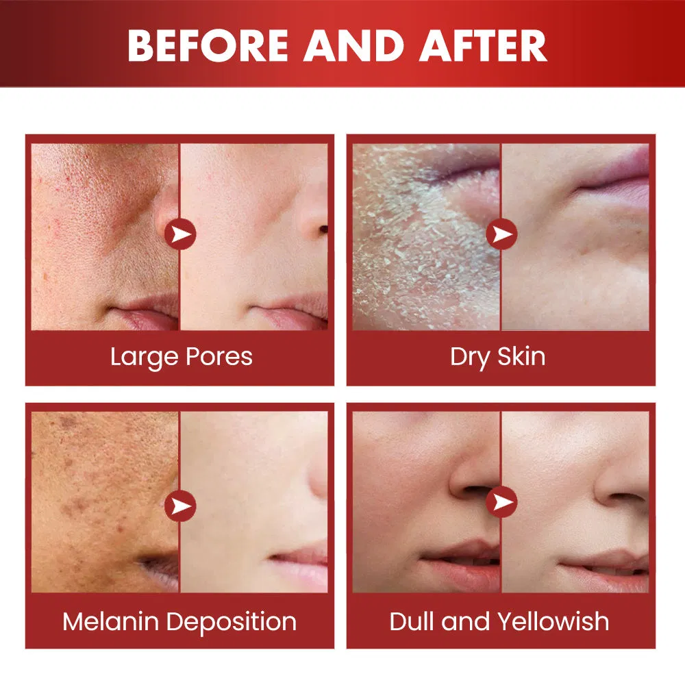 Body Care Skin Moisturizing Firm Whitening Dragon Blood Extract Body Lotion