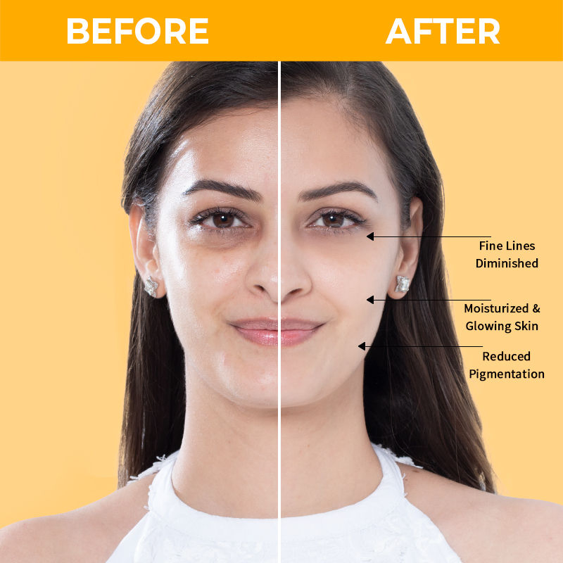 Collagen Anti Aging Dry Skin Private Label Vitamin C Moisturizing Face Cream