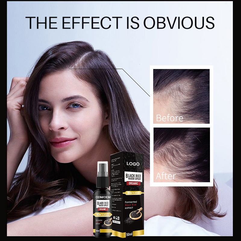 Aixin Beauty Cosmetics Skin Care Rice Water Hair Growth Serum for Longer Thicker Fuller Loss Hair Treatment Product Hair Growth Spray