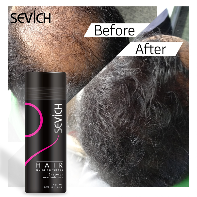 Hair Loss Treatment Fiber Full Hair Instantly Keratin Hair Building Fibers Powder