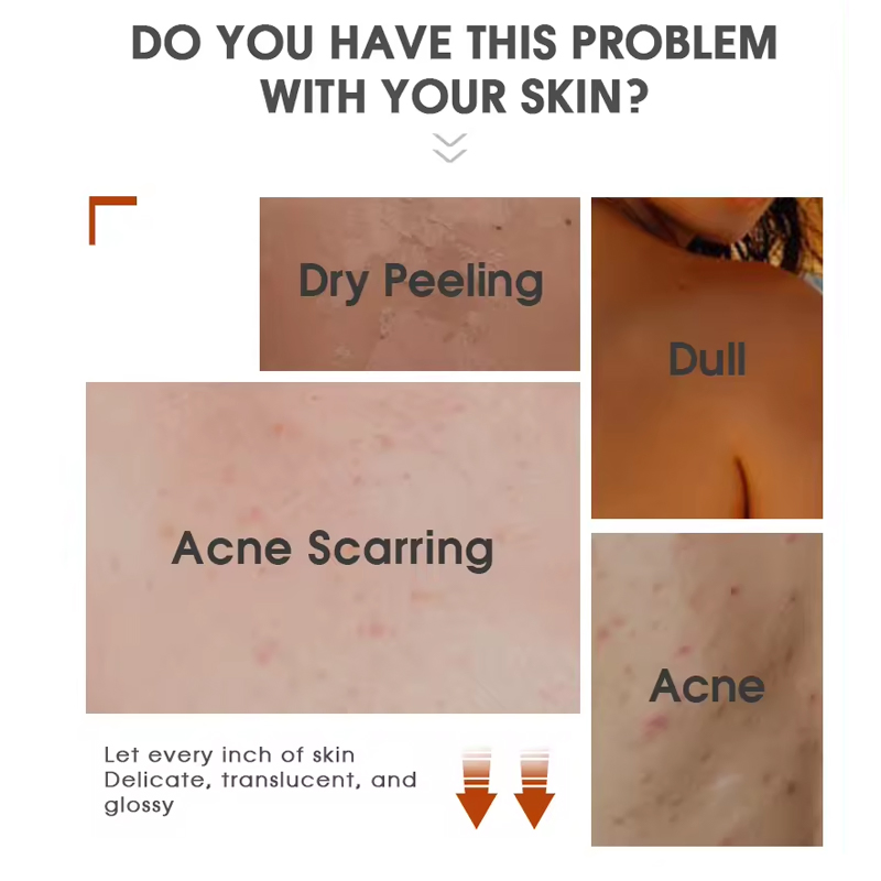 Ditong Oemodm Custom Hyaluronic Acid Carrot Skin Lightening Shower Gel