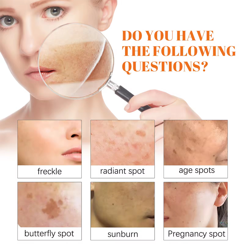 Ditong Papaya Whitening Freckle Cream