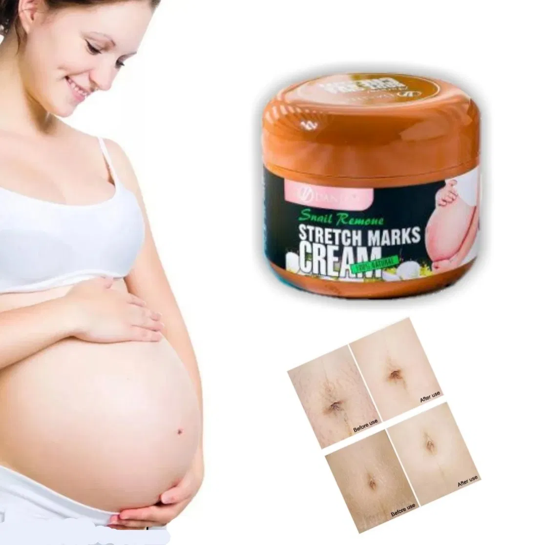 Snail Remove Stretch Marks Cream Beauty Product