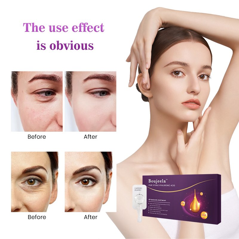 Disposable Skin Care Strong Anti Wrinkle Hyaluronic Acid Serum