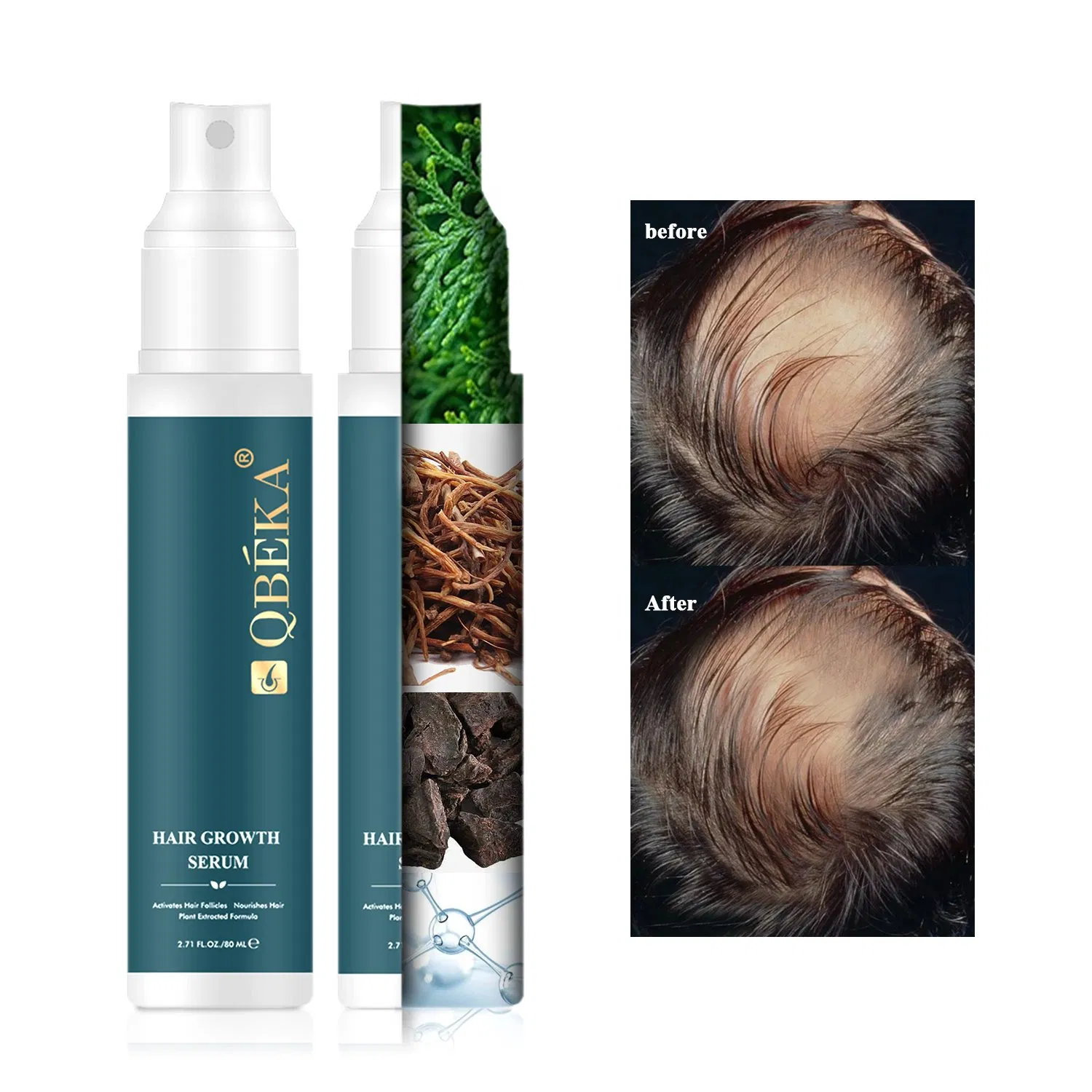Qbeka Hair Growth Spray for Thicker & Longer Hair