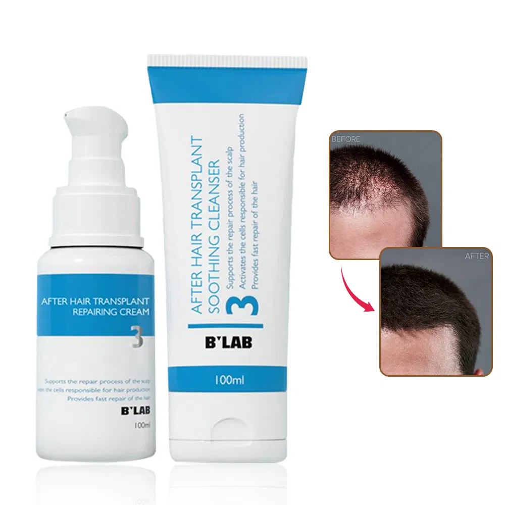 Private Label Natural Anti-Itching Head Scalp Care After Hair Transplant Repairing Cream