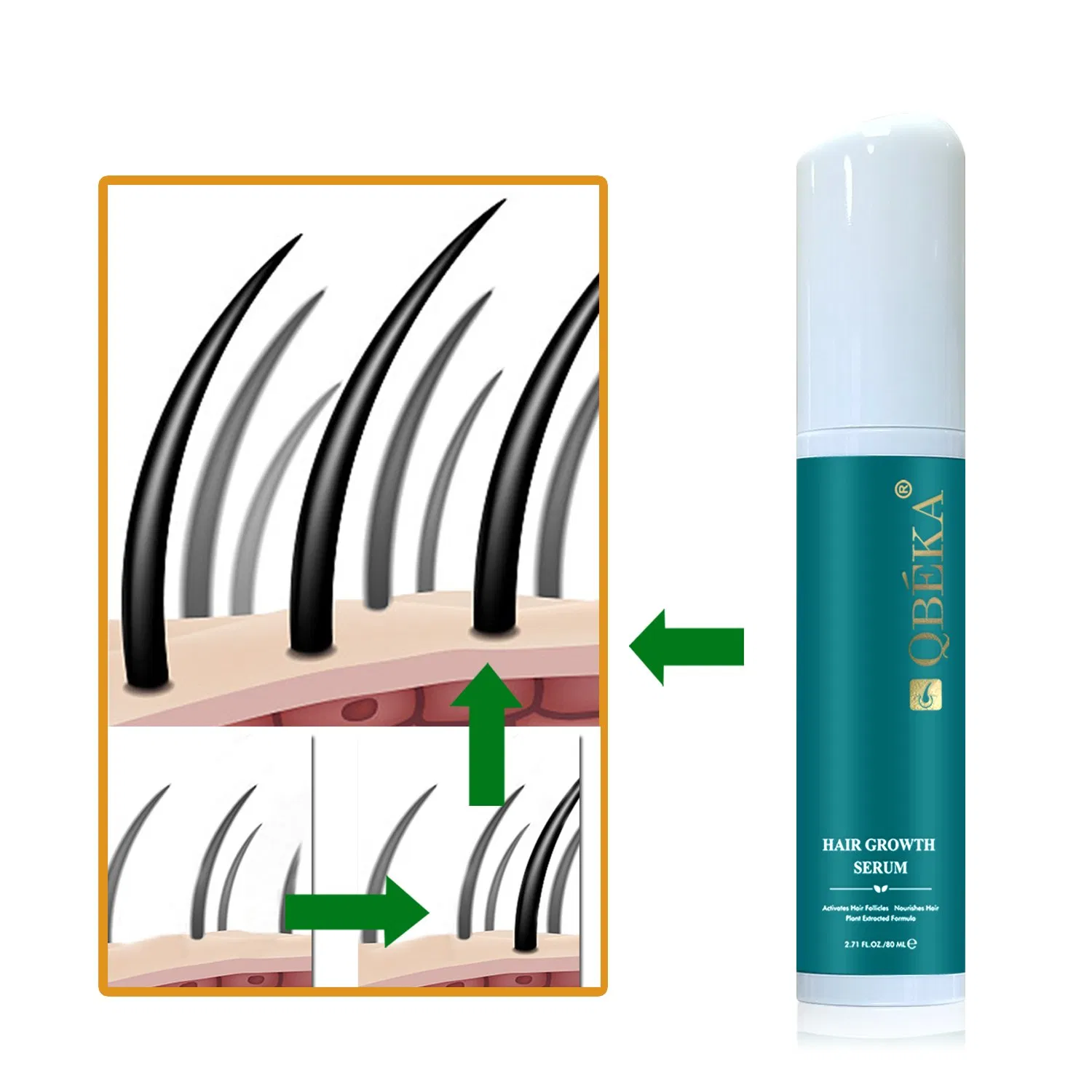 Hot Sell Qbeka Herbal Hair Loss Prevention Treatment Growth Serum