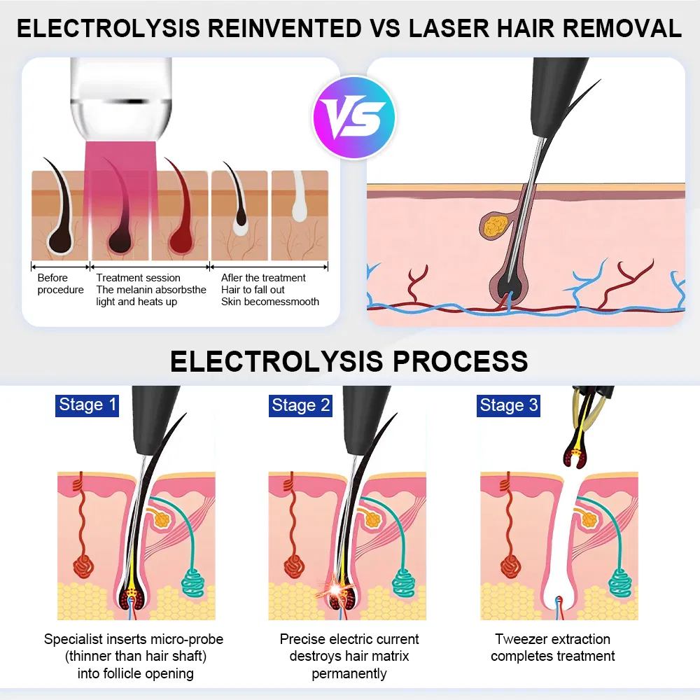 Permanent 5in1 Non-Laser Electrolysis Epilation Device Blend Electrolysis Hair Removal Needle Machine Face and Body Clinic Use