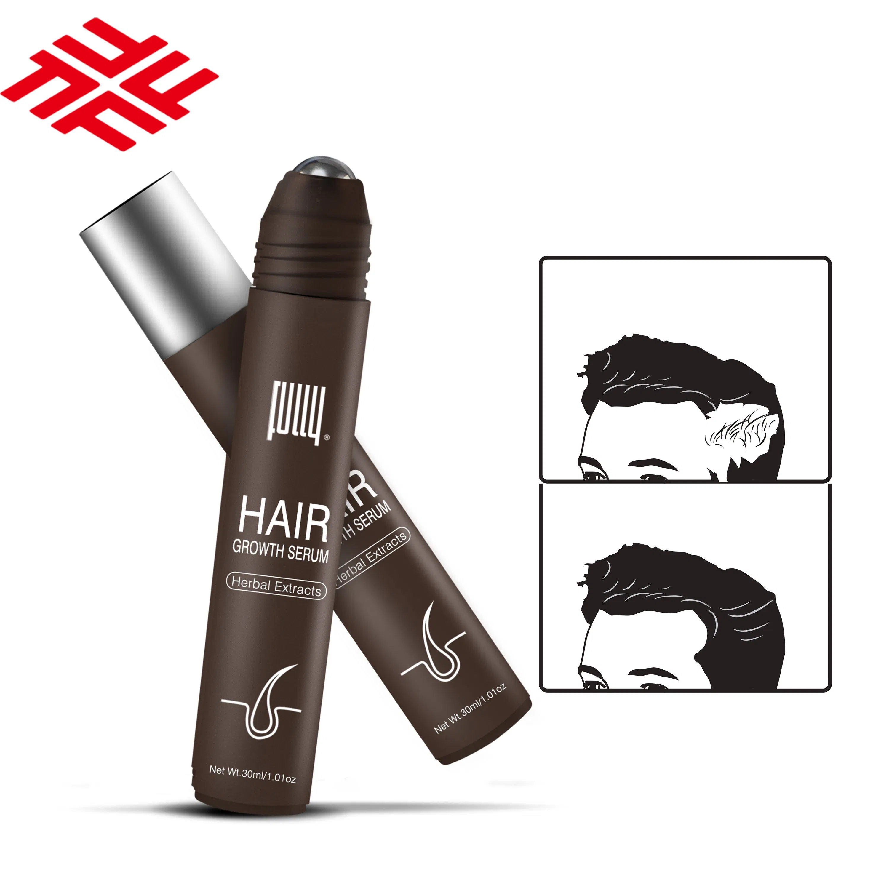 Professional Manufacturer Fully Hair Growth Serum Improve Hair Regrowth for Hair Loss