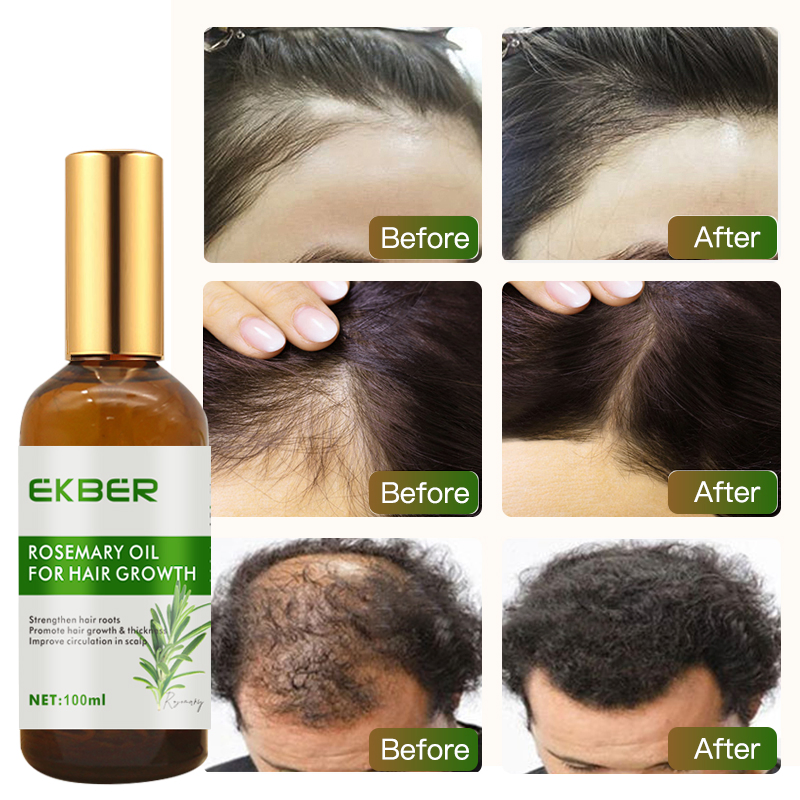 Private Label Natural Ingredient Rosemary Oil Hair Growth Male and Female Hair Regrowth Oil