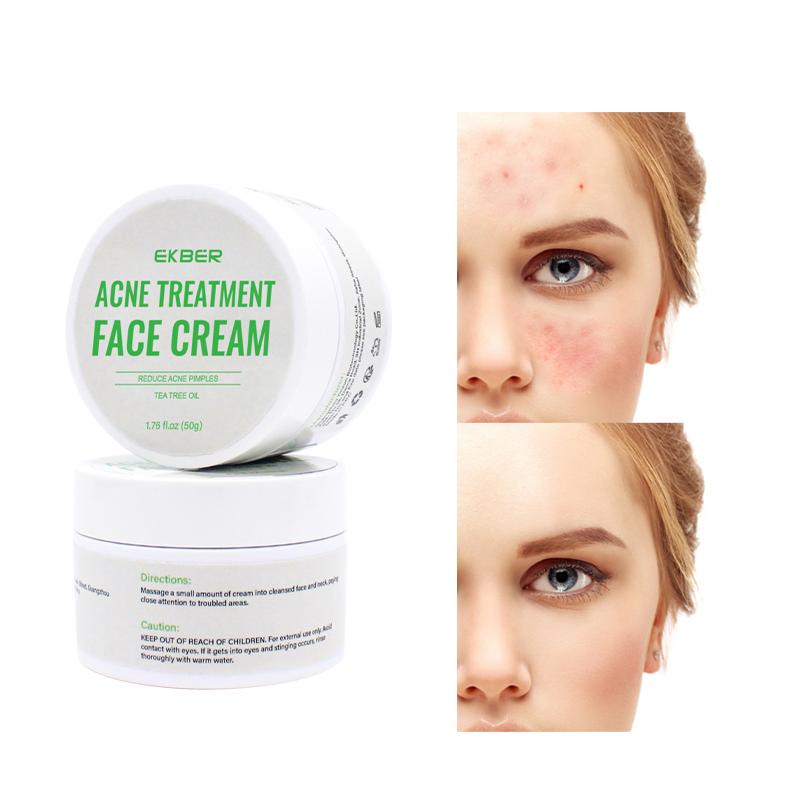Plant Extract Luxury Anti-Acne Smoothing Salicylic Acid Face Cleansing Cream Plant Extract Anti-Acne Face Cream