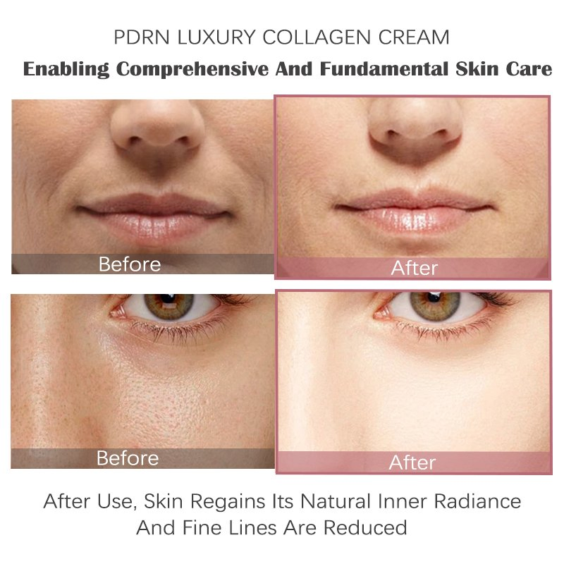 Pdrn Luxury Collagen Cream Pore Tightening Collagen Cream Shrink Pores Fading Fine Lines Salmon Pdrn Collagen Face Cream