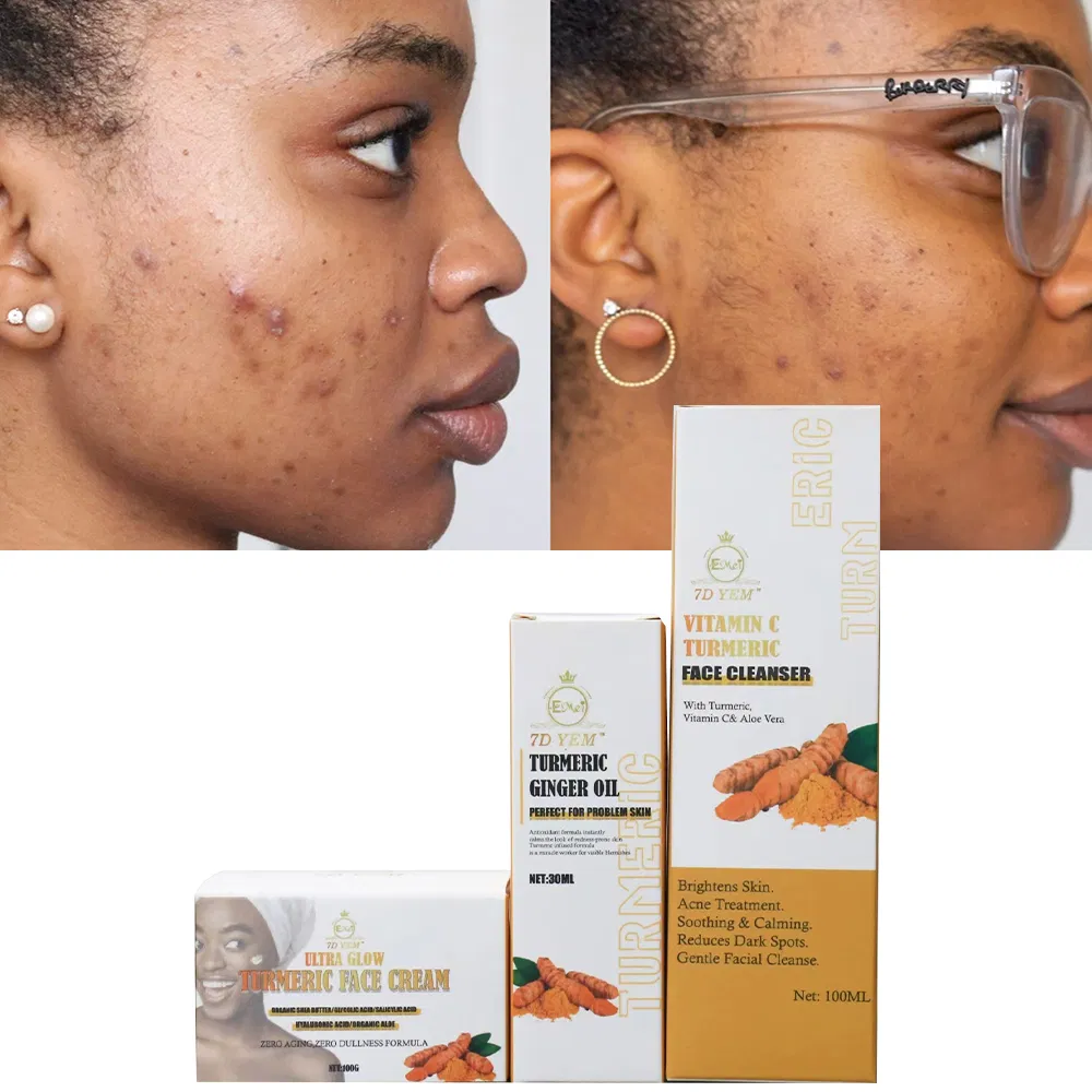 High Quality Turmeric Face Cleanser Vitamin C Deep Cleansing Face Skin Brightening Skin Turmeric and Kojic Acid Facial Cleanser