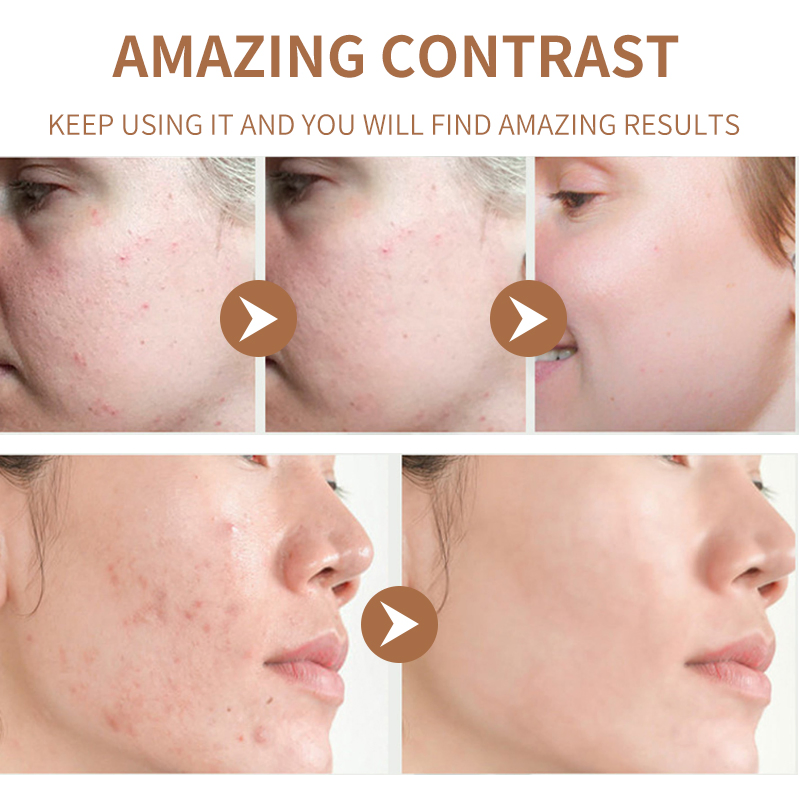 Calming Repairing Face Women Skin Care Product Recover Natural Herbal Soothing Cream