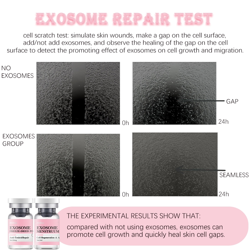 SPA Microneedle Freeze-Dried Powder Vegan Plant-Derived Exosome Anti-Aging Exosome Stem Cell EGF Revitalizing Micro Infusion Serum