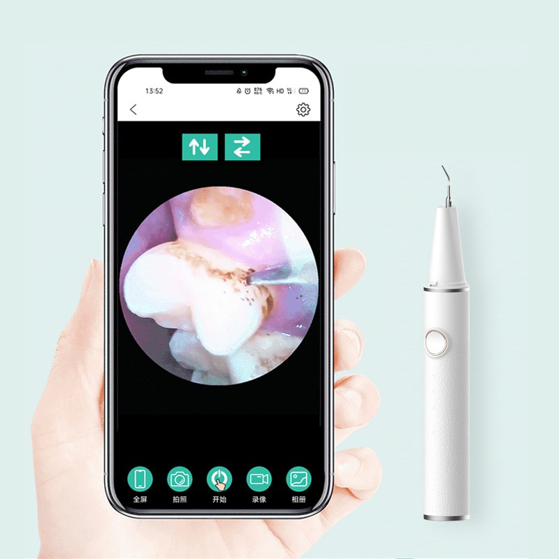 Visible Type 3 Gears Tooth Cleaner Electric Calculus Remover Ultrasonic Dental Scaler