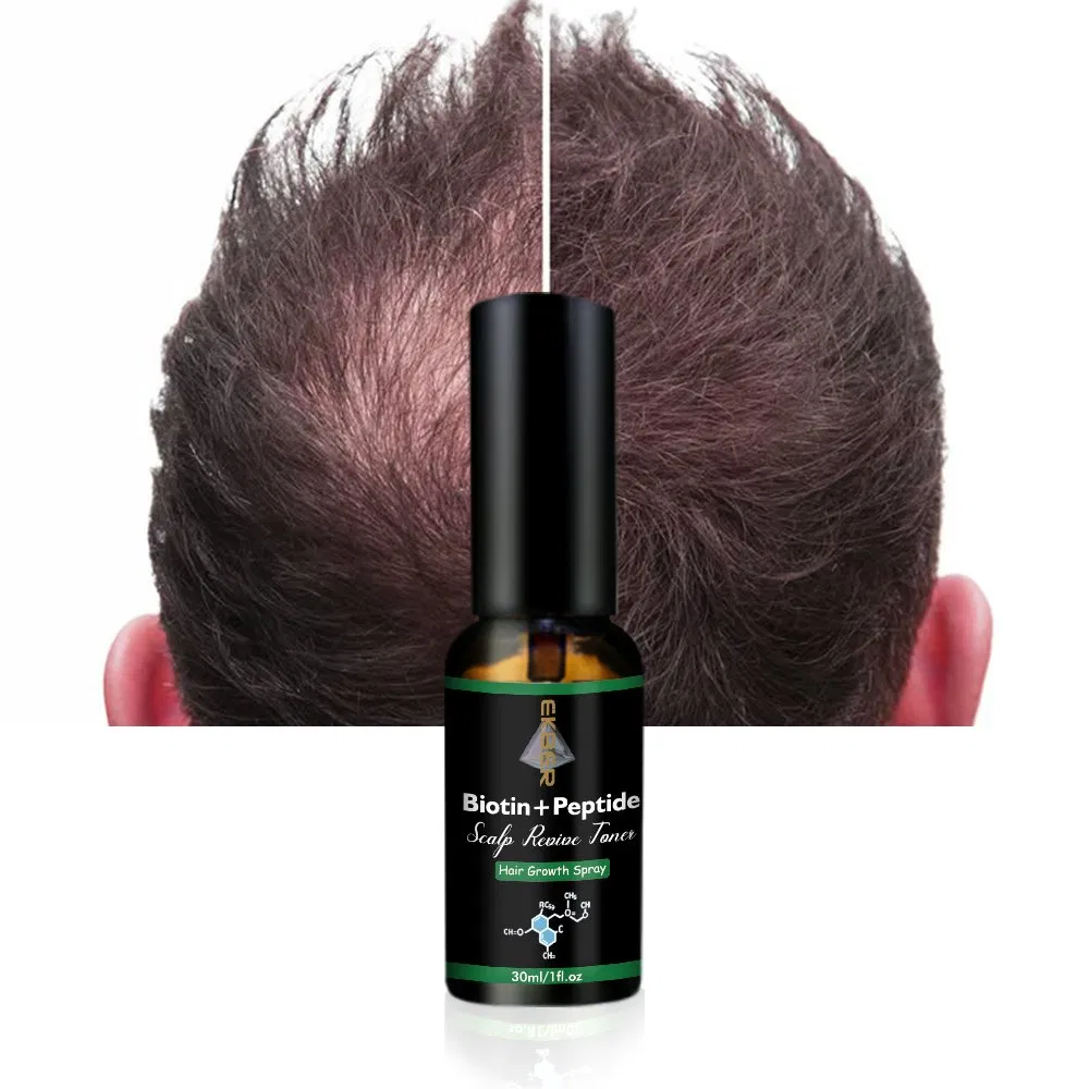 Natural Organic Vegan Hair Growth Serum Treatment Scalp Revive Toner Anti Loss Biotin Peptide Scalp Care Spray