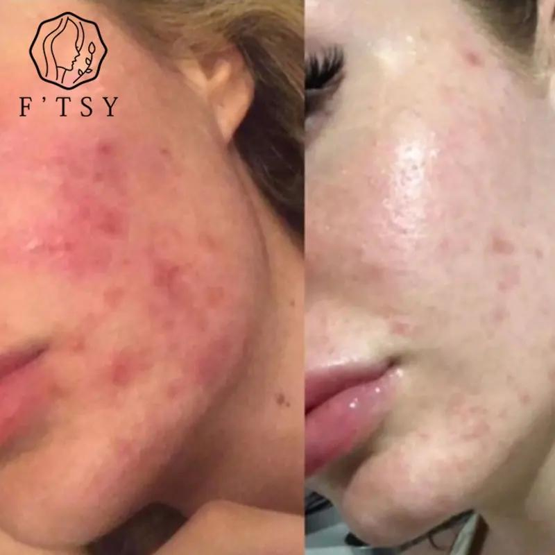 Private Label Vegan Healing Antioxidant Anti Redness Minty Green Smoothie Face Serum