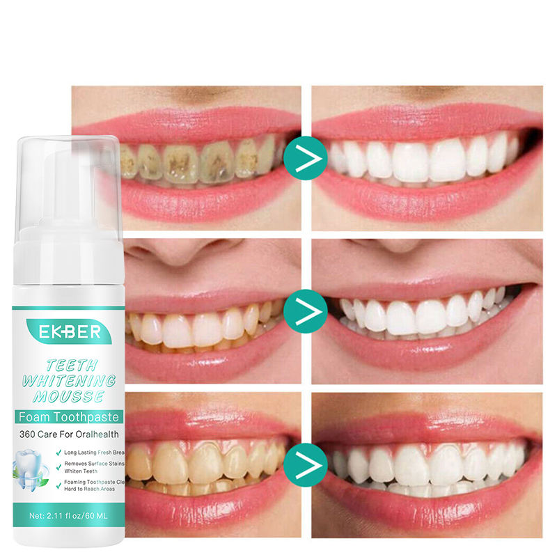 High Quality Organic Whitening Teeth Mousse Wholesale Tooth Deep Cleansing Remove Dental Tool Tartar Tooth Care
