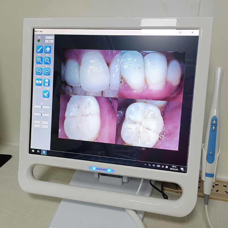 Professional Oral Equipment HD Touch Screen 720p Free Software Supported Dental Intraoral Camera All-in-One Computer