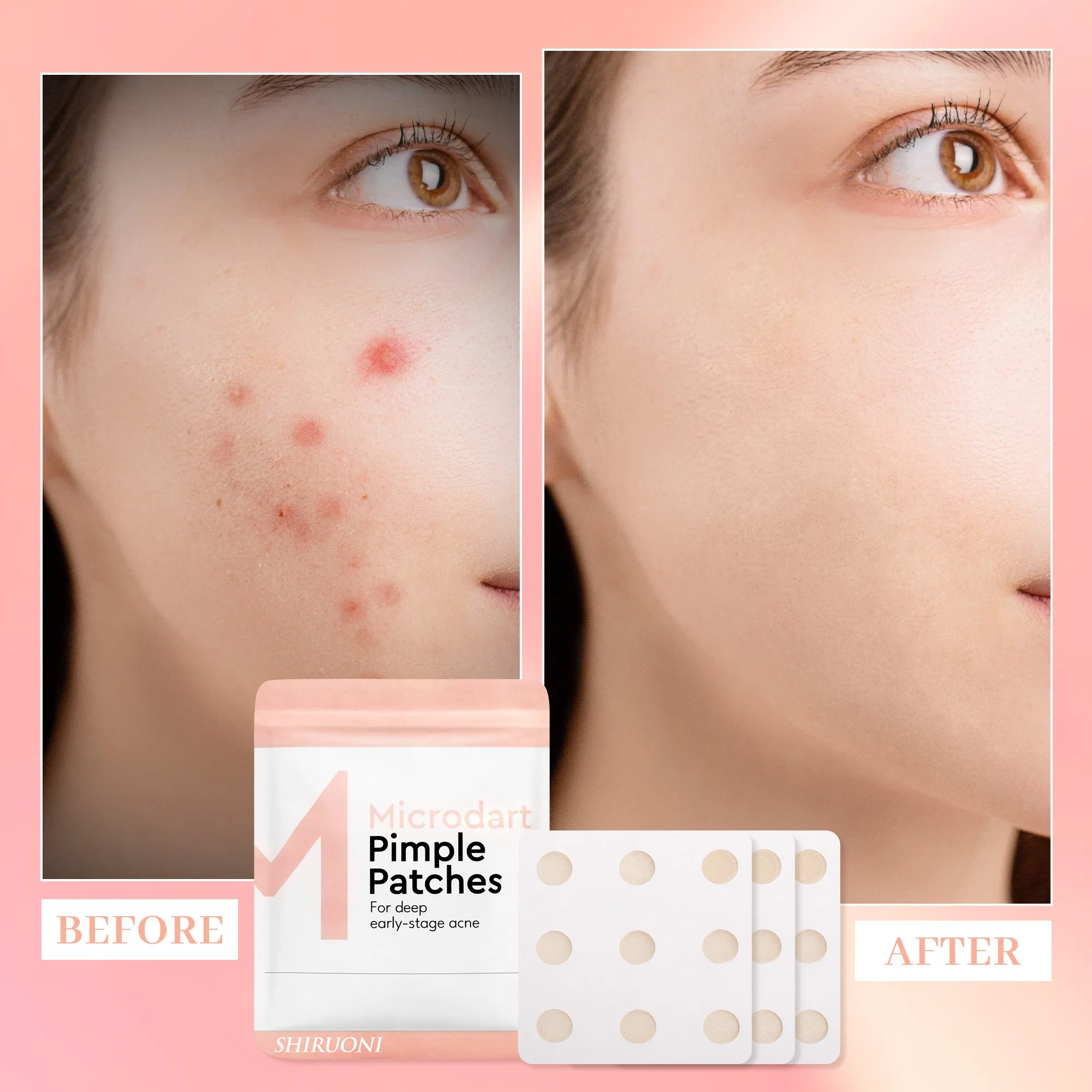 Custom Korean Pimple Patch Hydrocolloid Acne Microneedle Pimple Patch Private Label Cute Invisible Pimple Patches