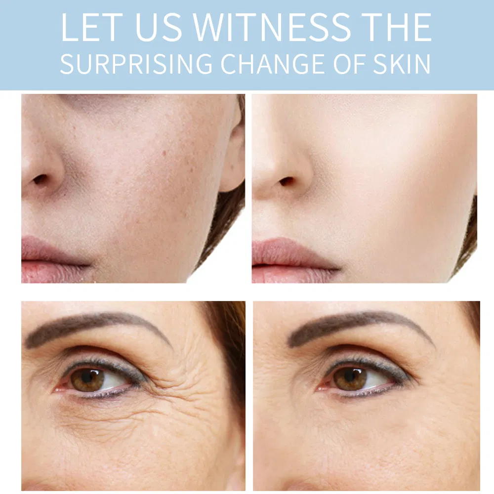 OEM Natural Vegan Bleaching Skin Whitening Eye Face Retinol Anti Aging Cream