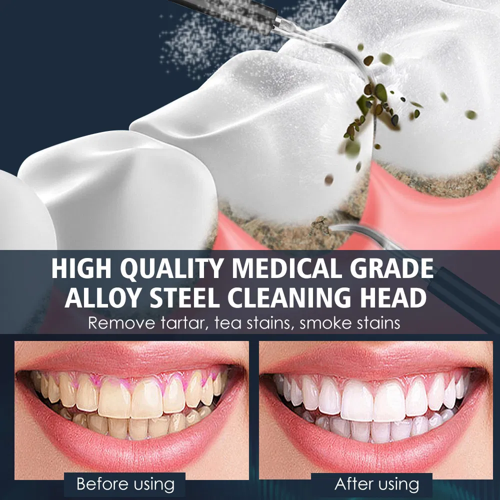 Personal Care Ultrasonic Tooth Scrubber Two-in-One Tartar and Calculus Remover Electric Toothbrush