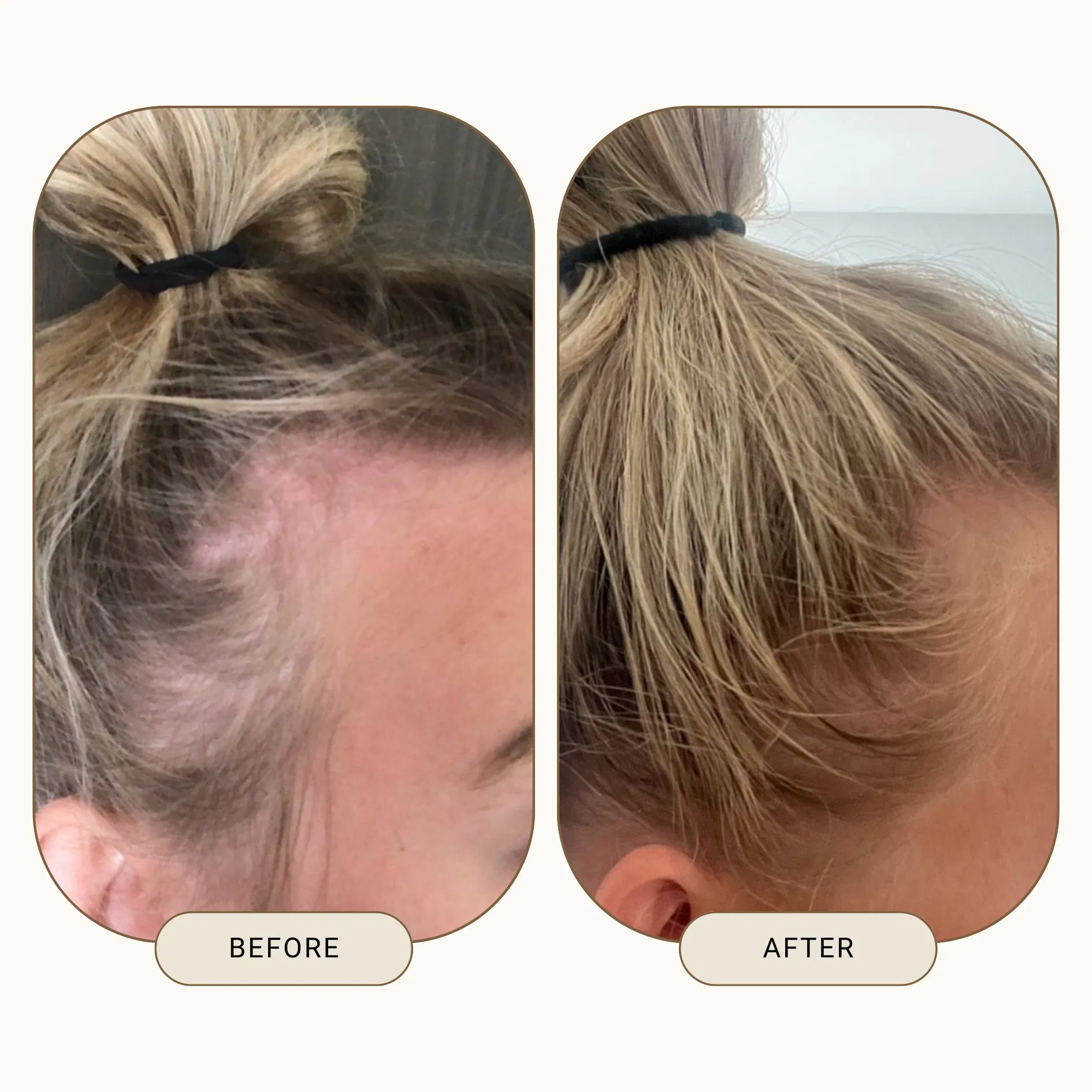 Private Label 100% Natural Rosemary Castor Oil Nourishing Scalp Elixirs Hair Care Loss Treatment Hair Growth Oil