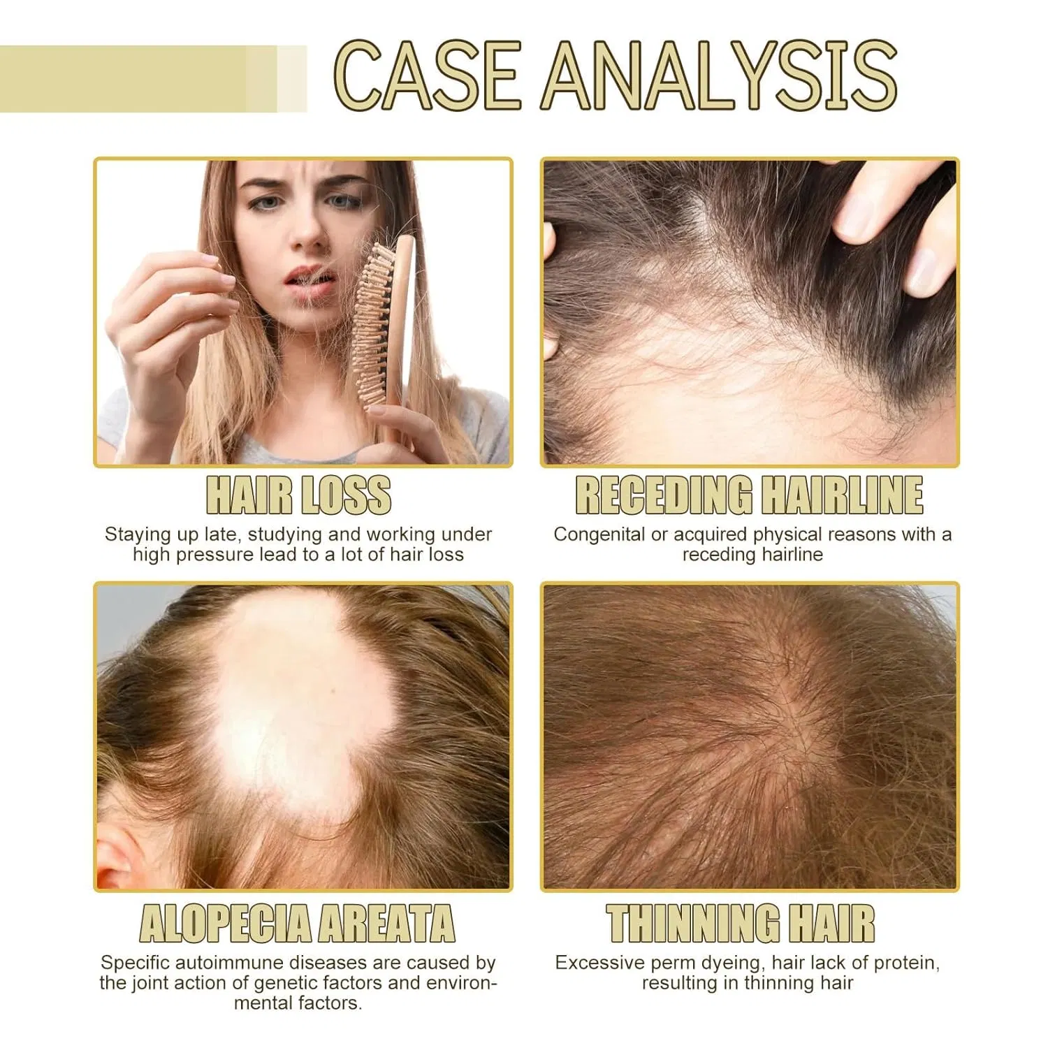 Private Label 100% Natural Rosemary Castor Oil Nourishing Scalp Elixirs Hair Care Loss Treatment Hair Growth Oil Serum