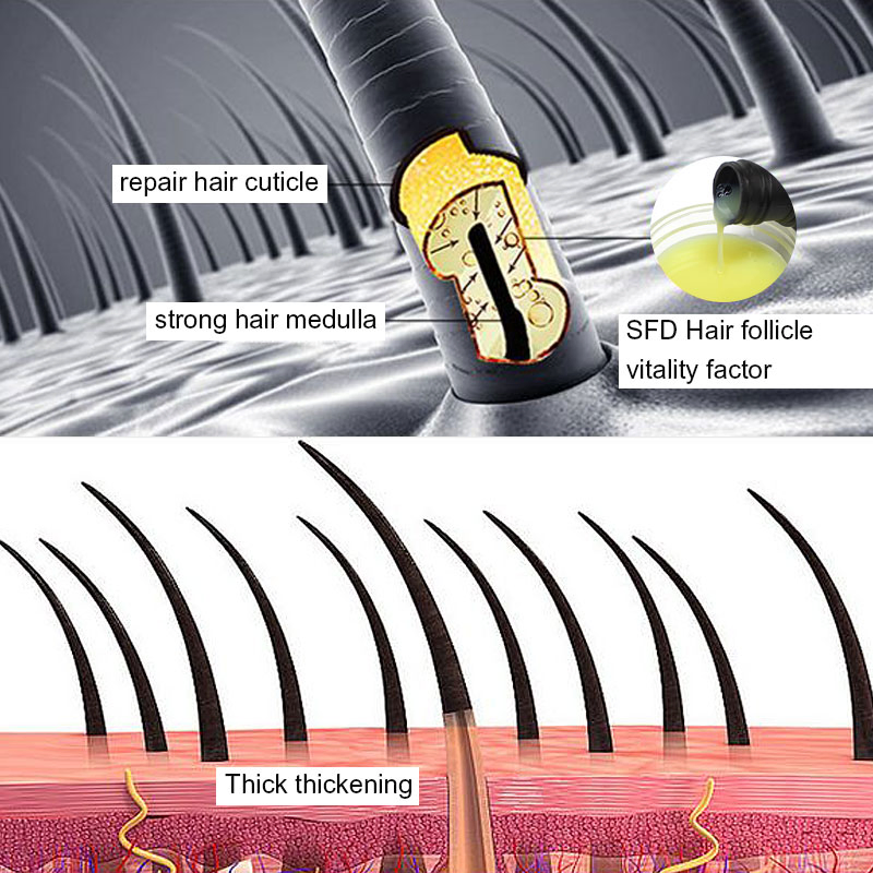 Effective Thin Hair Solution Prevent Hair Loss Shampoo