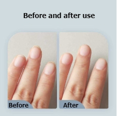 UFO Ergonomic Stainless Steel Nail Clippers with Safety Edge - Compact Design for Professional and Personal Use