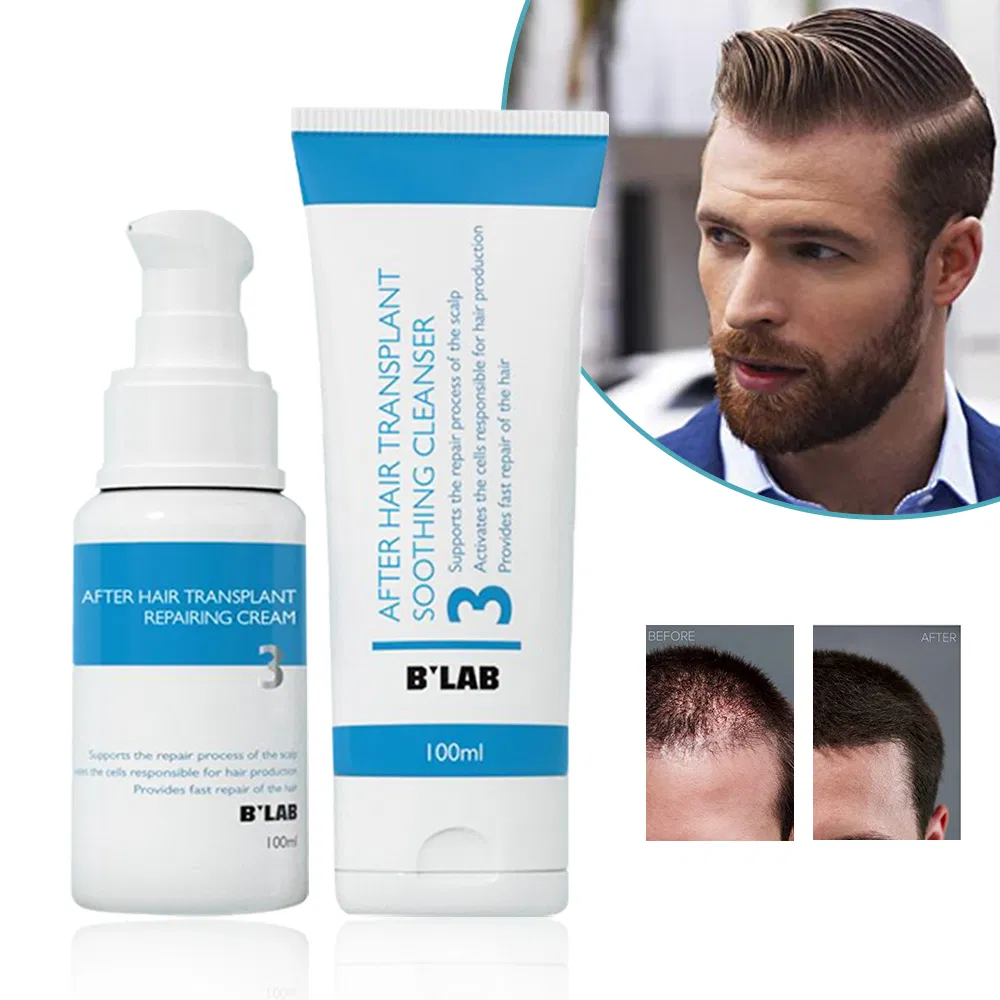 Customize Natural Head Scalp Care After Hair Transplant Repairing Cream